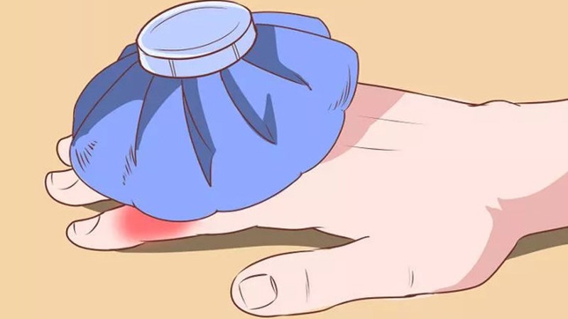 5 cách chữa viêm khớp ngón tay chuẩn khoa học bạn nên biết