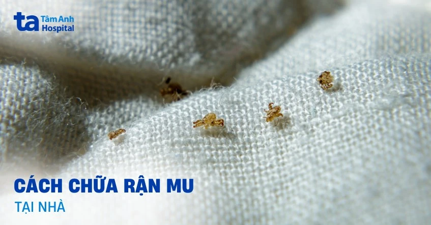 Cách chữa rận mu tại nhà hiệu quả và an toàn