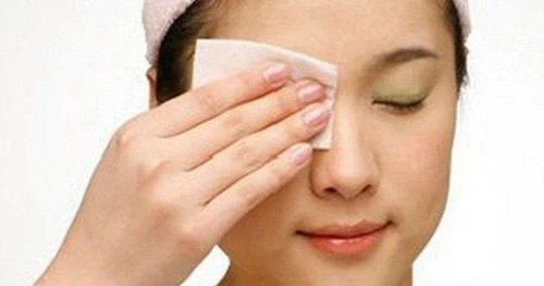 Cách chữa viêm bờ mi mắt tại nhà nhanh nhất và hiệu quả