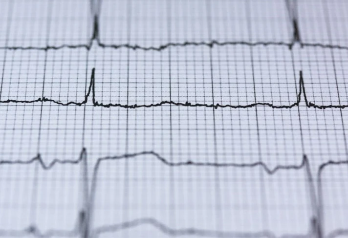 Cách mắc điện tim chính xác và hiệu quả