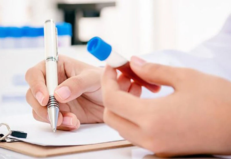 Cách đọc chỉ số xét nghiệm gan để theo dõi sức khỏe