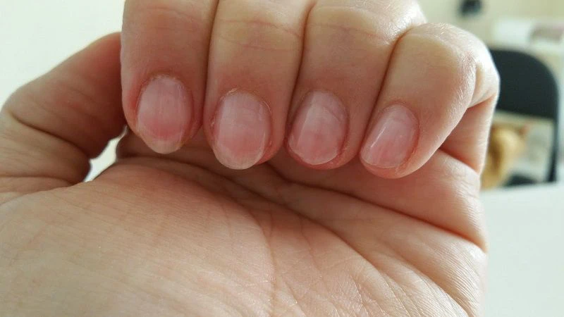 Cách để móng tay dài nhanh và khỏe mạnh