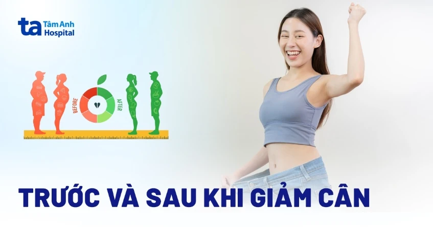 Lợi ích của việc theo dõi ảnh giảm cân hiệu quả