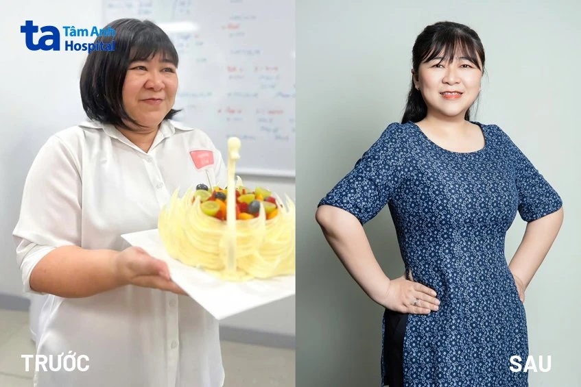 Hình ảnh trước và sau khi giảm cân: Quá trình thay đổi và duy trì