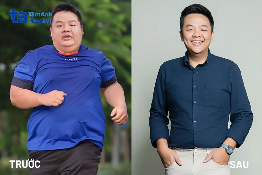 Hình ảnh trước và sau khi giảm cân: Quá trình thay đổi và duy trì