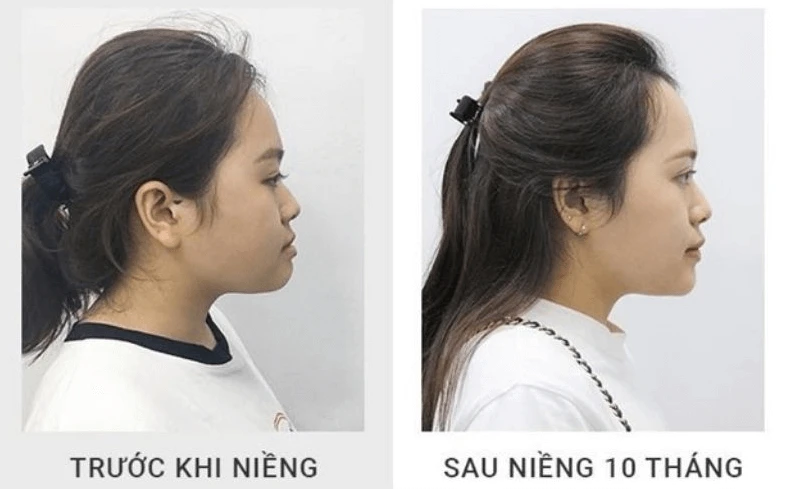 Sau khi trải qua biến cố lớn trong cuộc đời